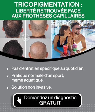La tricopigmentation