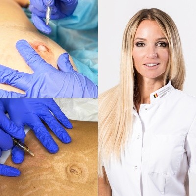 Choosing your paramedical dermopigmentation specialist