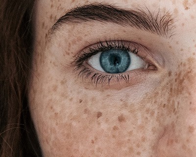 Freckle permanent make-up