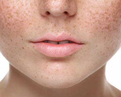 Permanent freckle make-up in Belgium