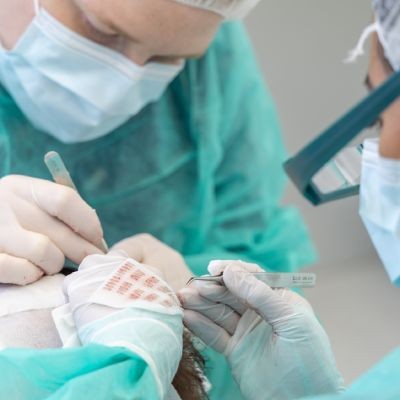 Tricopigmentation associée à une greffe : bonne idée ? 